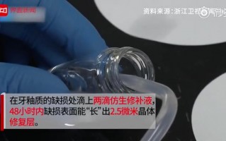 黑科技镶牙 浙大专家发明牙齿修复黑科技：两滴药水，“长”出牙釉质